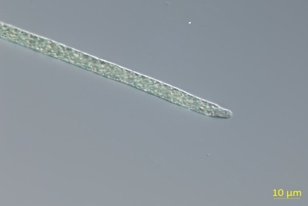 1.+Planktothricoides+raciborskii+미분간섭현미경+사진(×1，000배).jpg