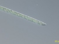 1.+Planktothricoides+raciborskii+미분간섭현미경+사진(×1，000배).jpg width: 200px; height : 150px