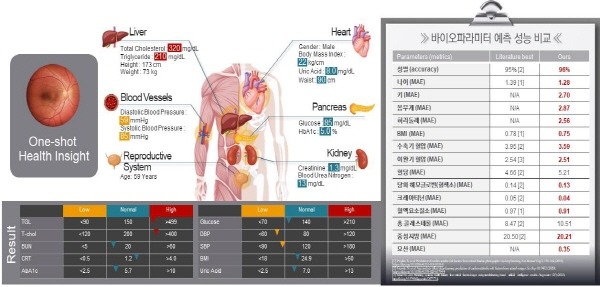 안저영상+기반+바이오+파라메타+예측+모델+및+성능.jpg